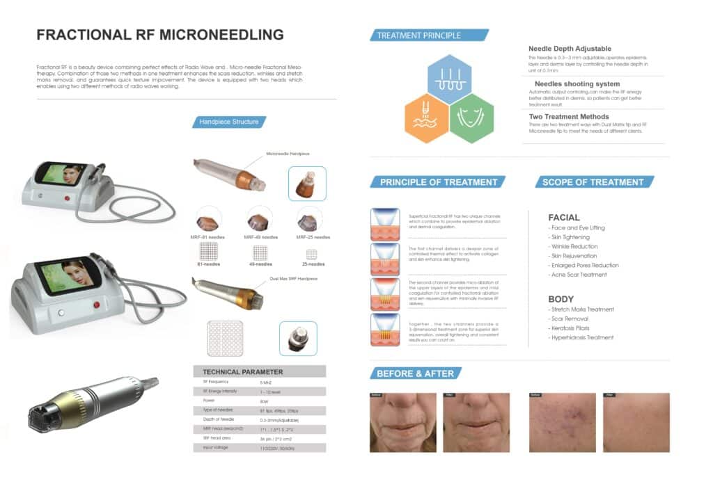 Ansiktsbehandling med Fractional RF Microneedle